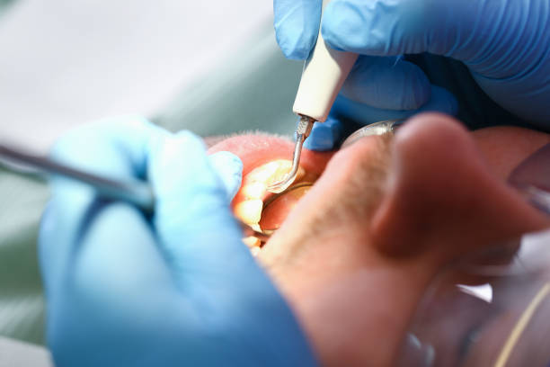 Best Emergency Broken Tooth Repair in Columbus, IN
