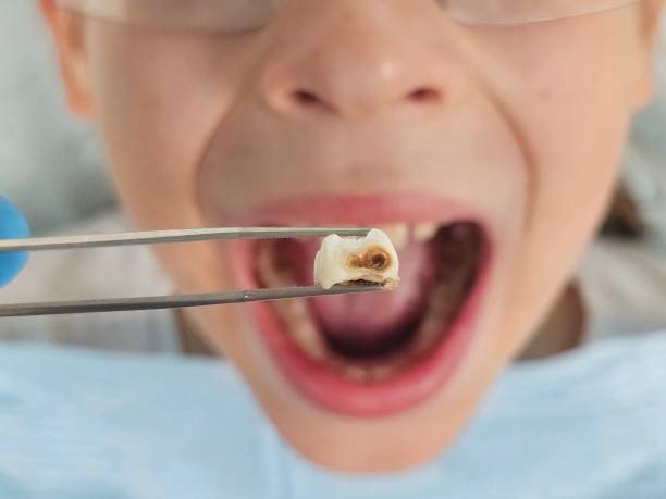 Best Pediatric Emergency Dentist in Columbus, IN