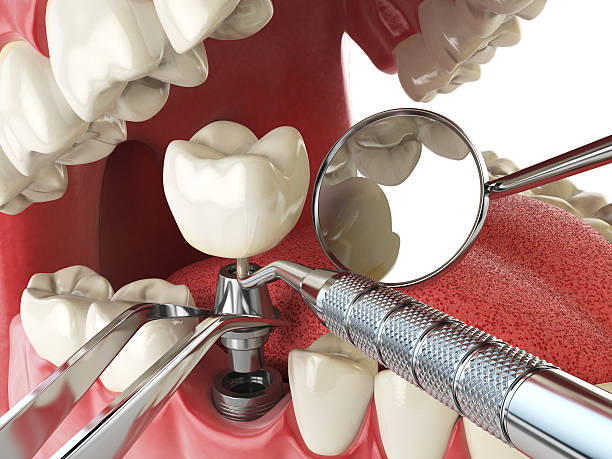 Best Emergency Treatment for Toothache in Columbus, IN